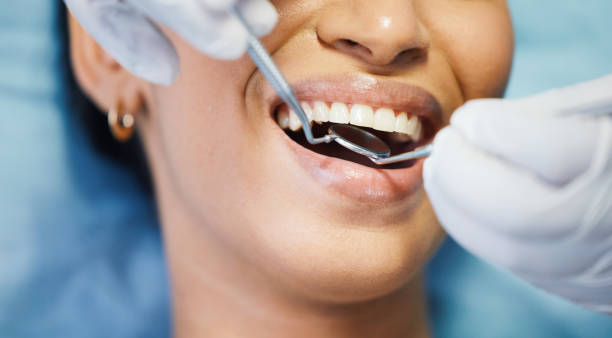 Best Mobile Emergency Dentist in Mountlake Terrace, WA